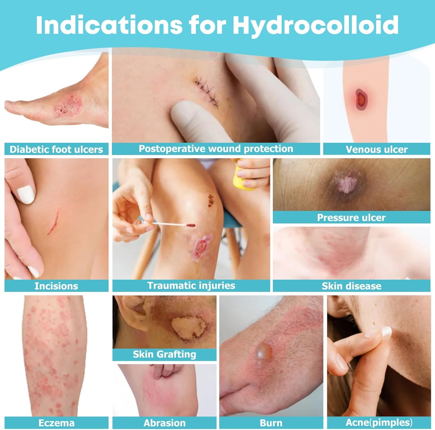 Hydrocolloid Roll for Wound Care