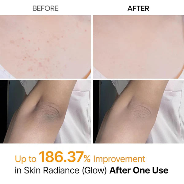 Body Peel Shot Spray